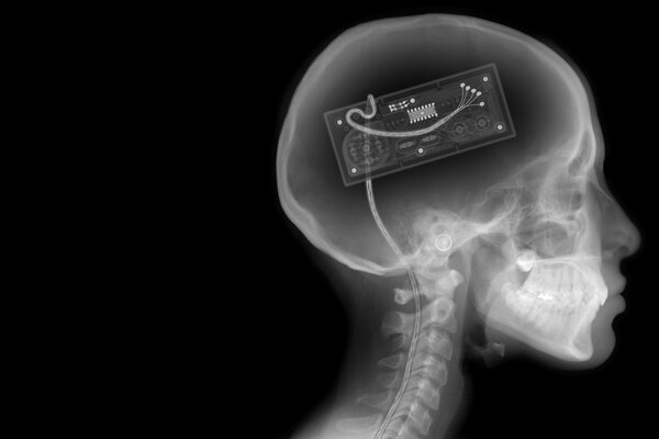 A gamepad in the skull on an X-ray. Skeleton on a black and white background