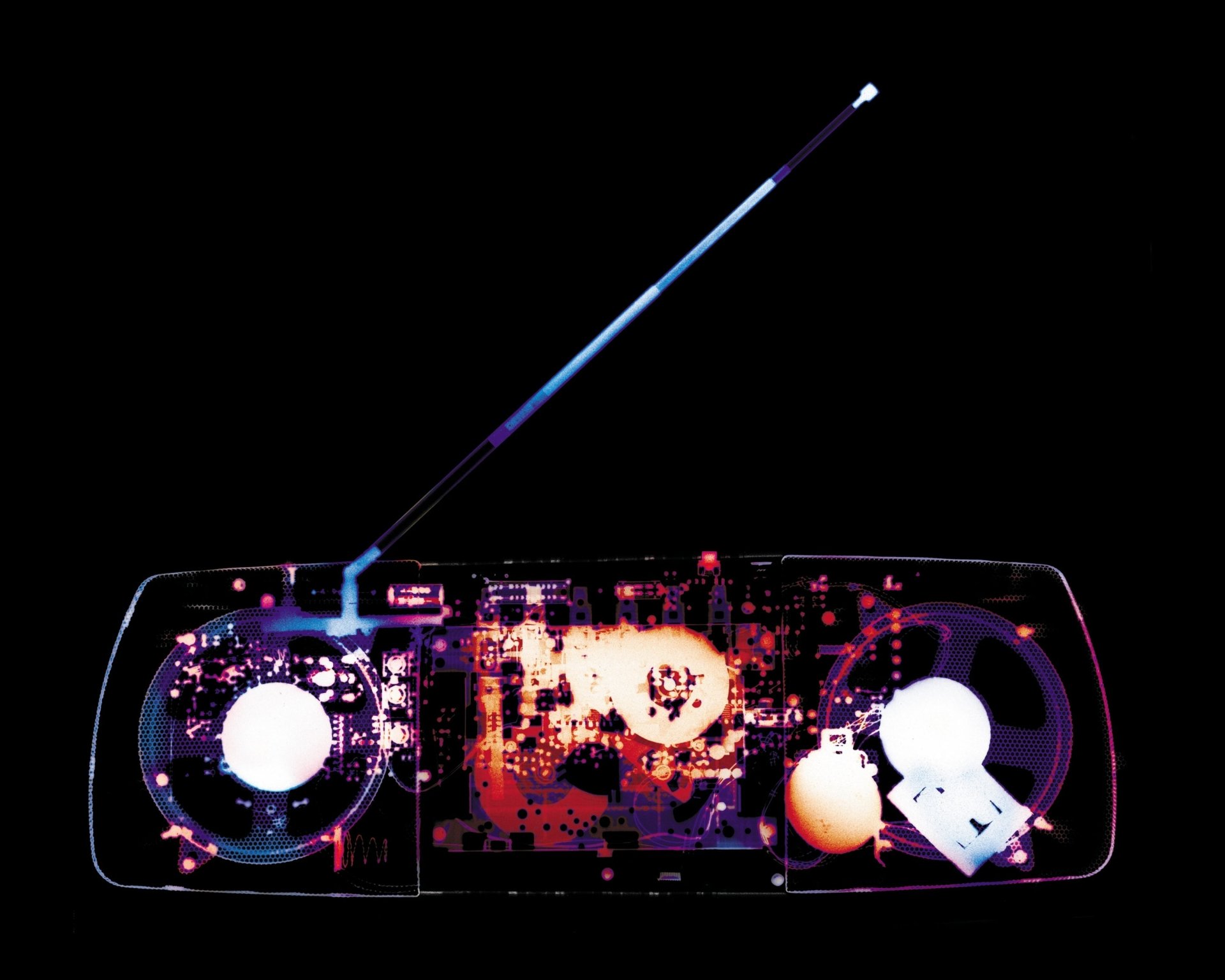 magnitafon antenna x-ray