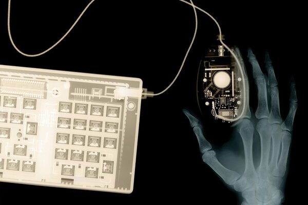 X-ray of the hand with the image next to the keyboard