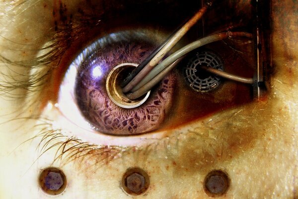 Biomechanical image of an eye with wires