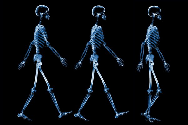 Drei Skelette im Röntgenbild