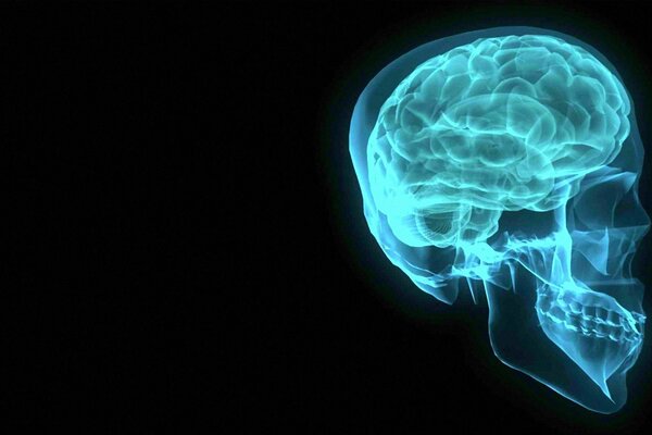 Radiografía de la cabeza y el cerebro de color azul sobre fondo negro