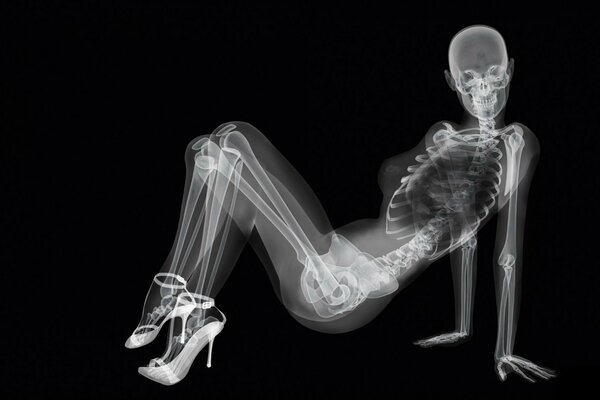 Sexy x ray chica en tacones