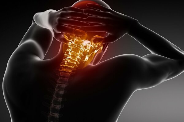 Rengen of the back pain in the spine