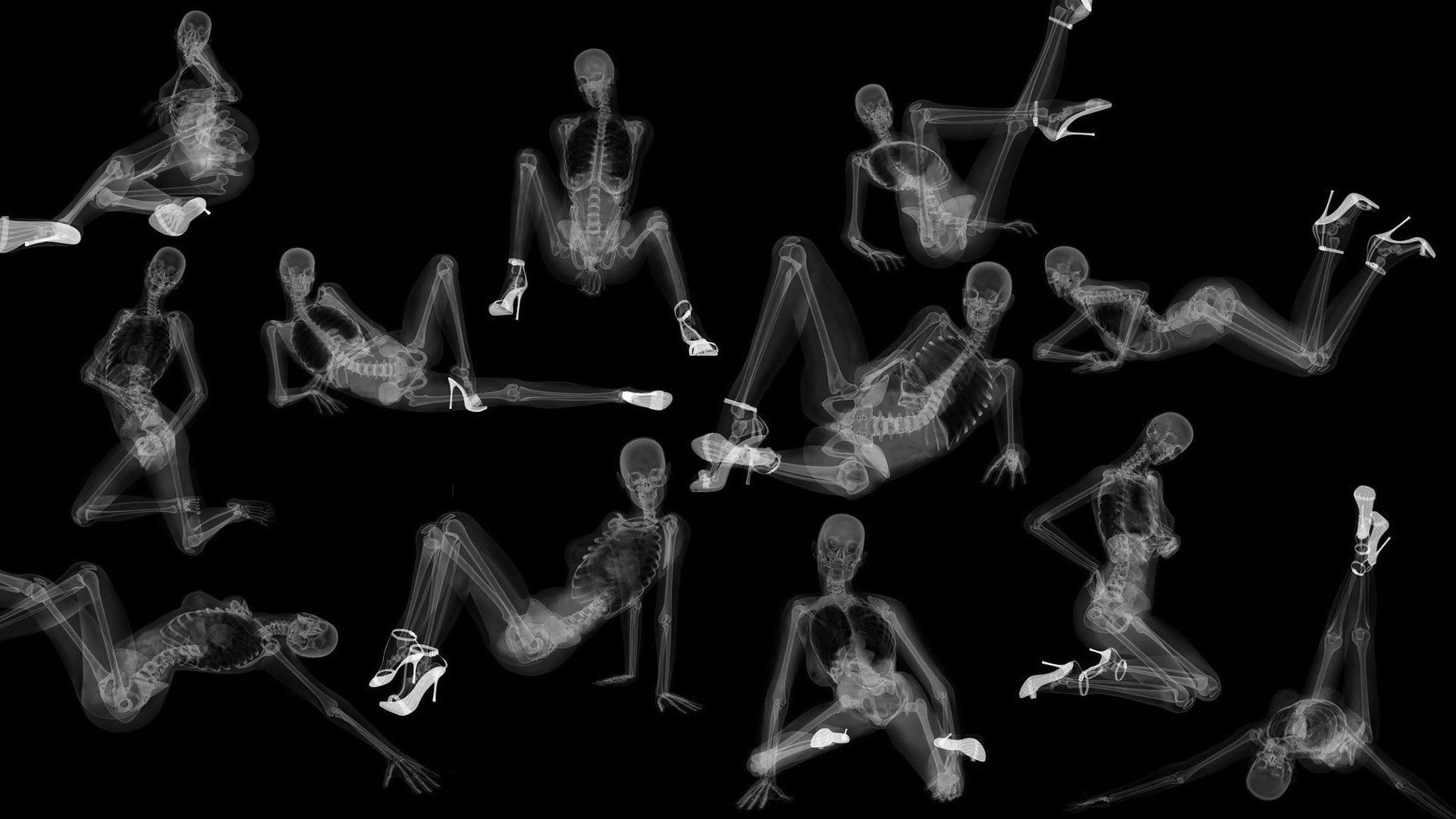 x-rays girls style