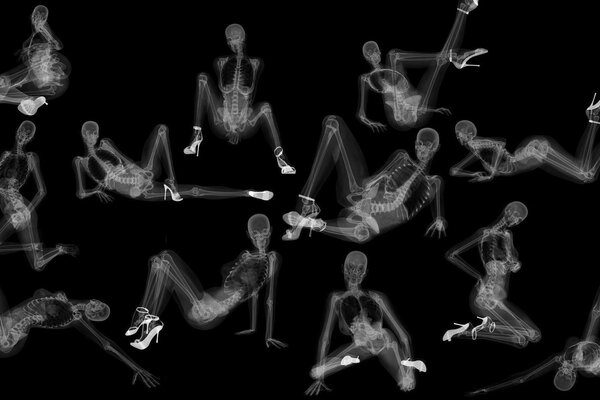 The skeleton of a sexy girl on an X-ray