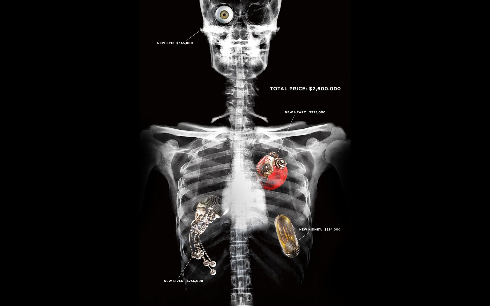 repoman rippers skeleton x-ray